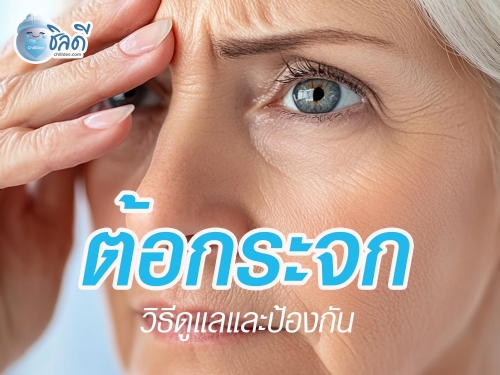 ต้อกระจกคืออะไร และวิธีดูแลป้องกัน
